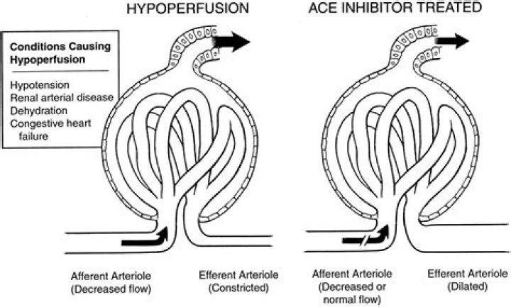 Are ACE inhibitors nephrotoxic
