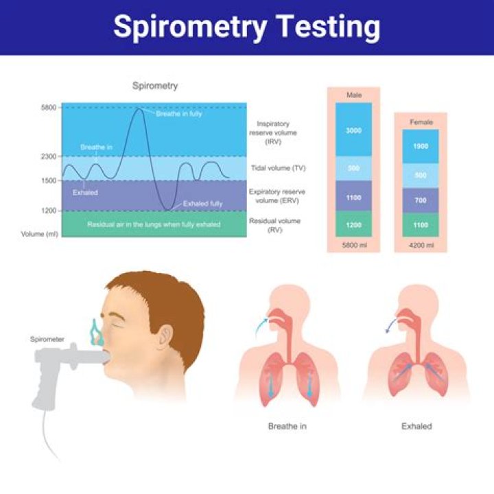 Are spirometry tests accurate