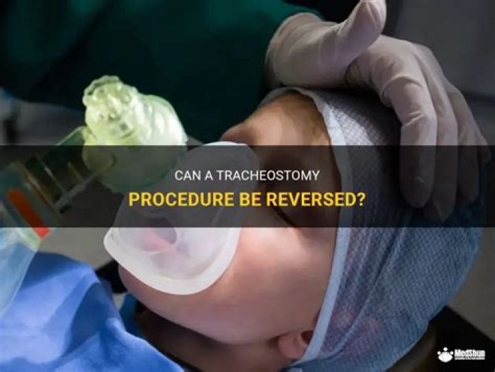 Can a tracheostomy be reversed