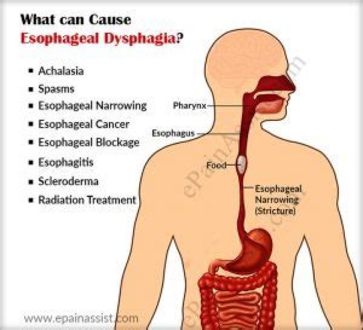 Can esophageal dysphagia be cured
