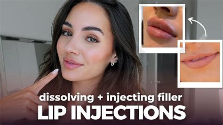 Can I inject fillers yourself