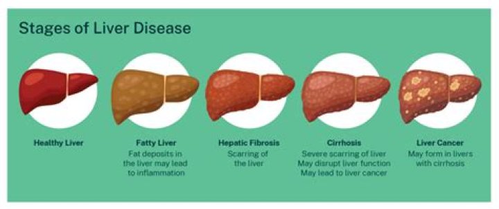 Can liver necrosis be reversed