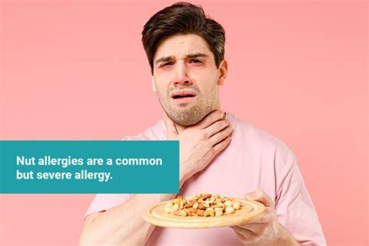 Can nut allergies be prevented