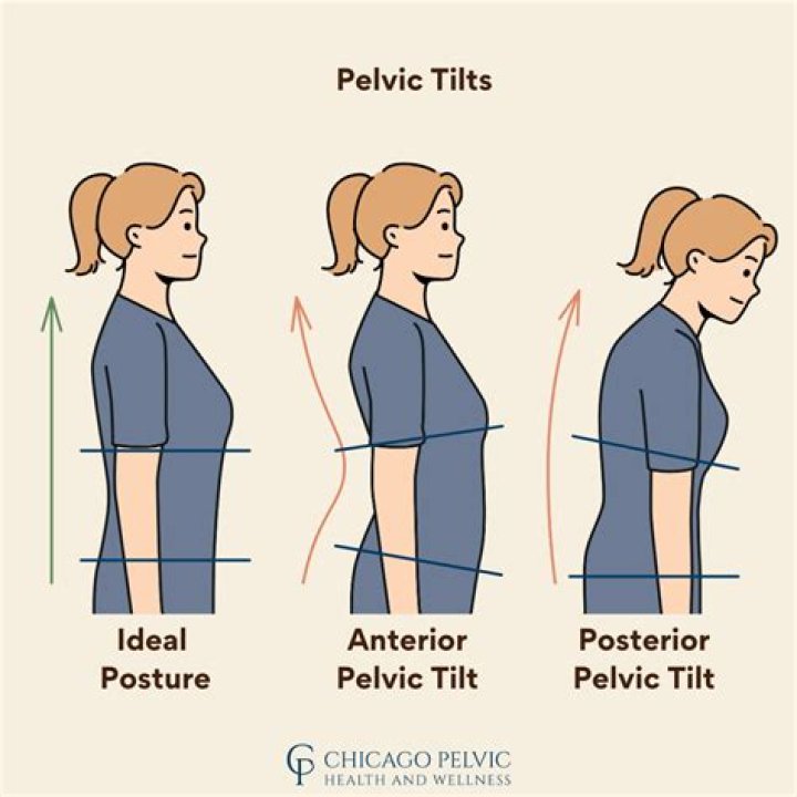 Can pelvic tilt cause back pain