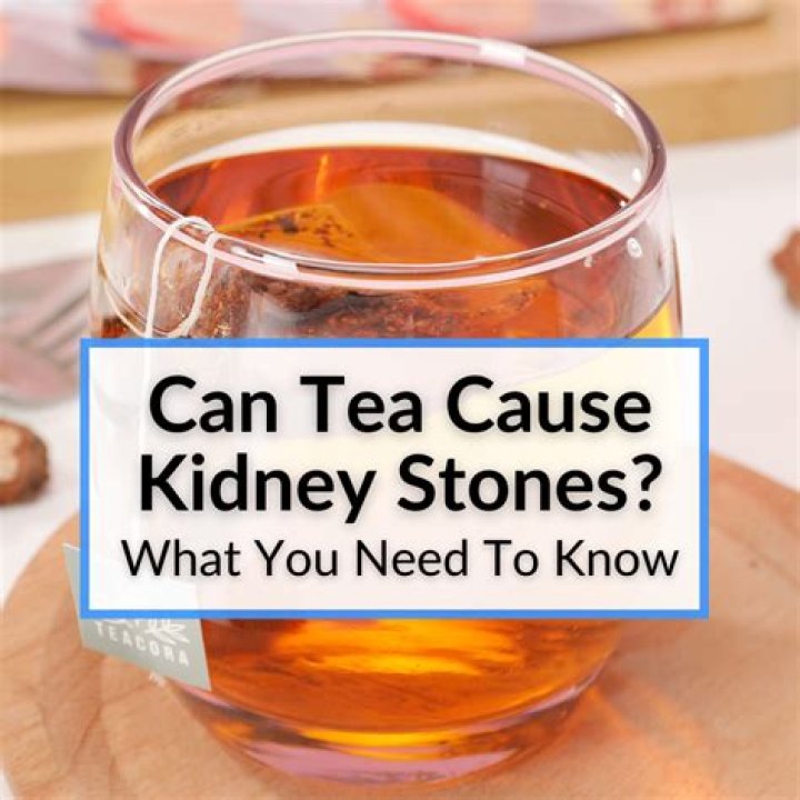Can tea give you kidney stones