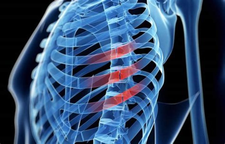 Can you fracture rib cartilage
