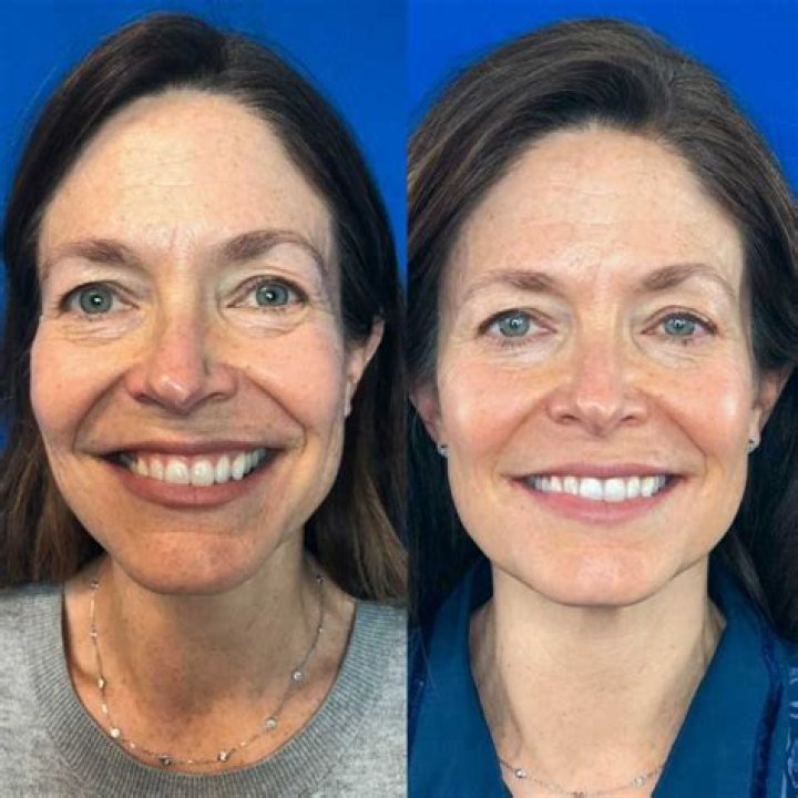 Can you reverse aging eyesight