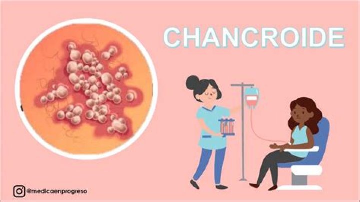 ¿Cómo se transmite el chancro