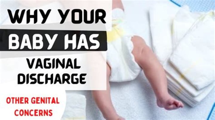 Do you wipe newborn discharge