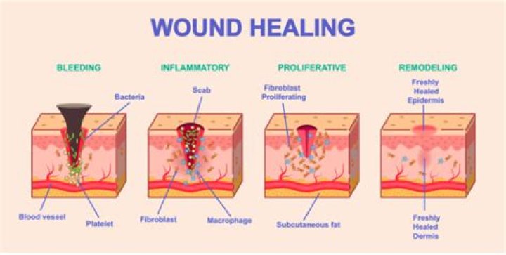 Does a red wound mean its healing