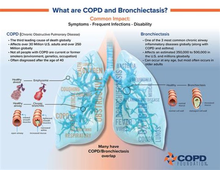 Does bronchiectasis count as COPD