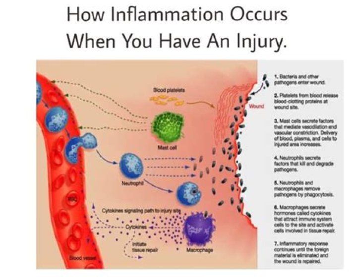 Does heat make inflammation worse