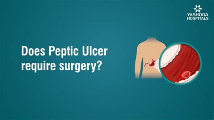 Does peptic ulcer require surgery