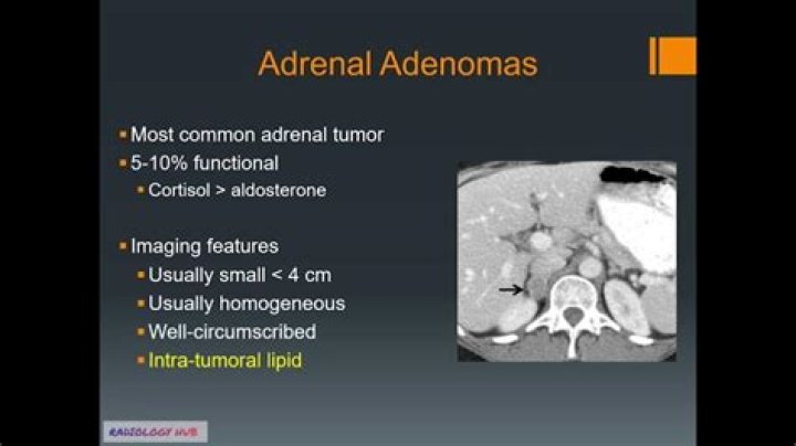 How do you treat adrenal mass