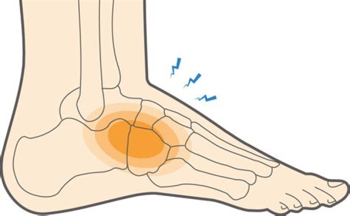 How do you treat midfoot pain
