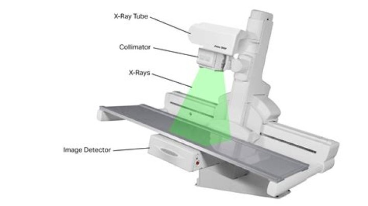 How does digital fluoroscopy work