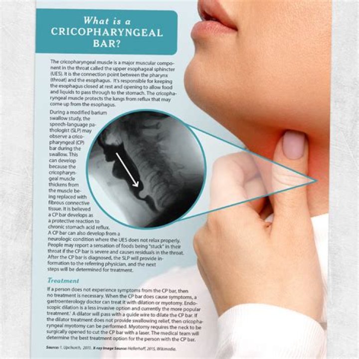 How is a Cricopharyngeal bar treated