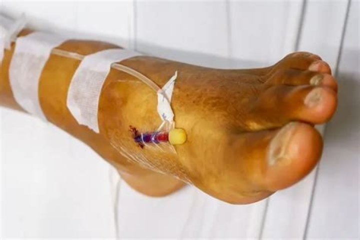 How long can you leave Adaptic on