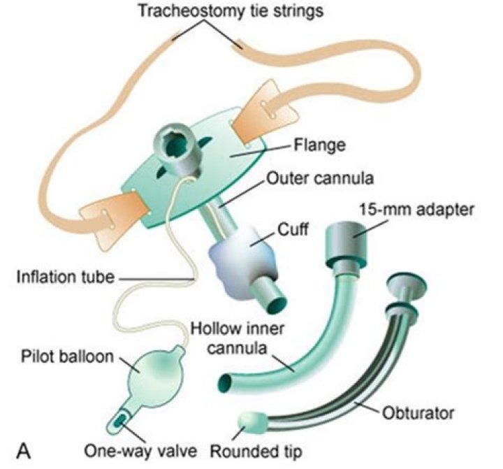 How long does a trach stay in