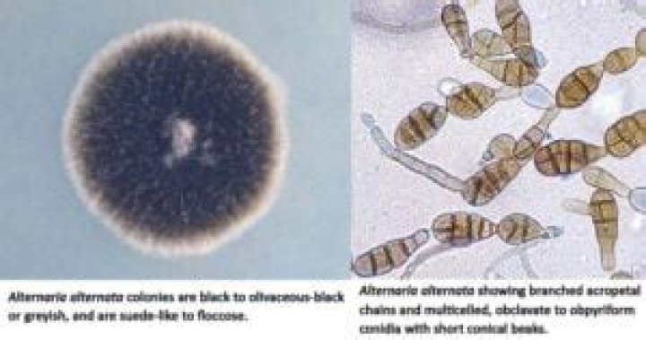 Is Alternaria dangerous to humans