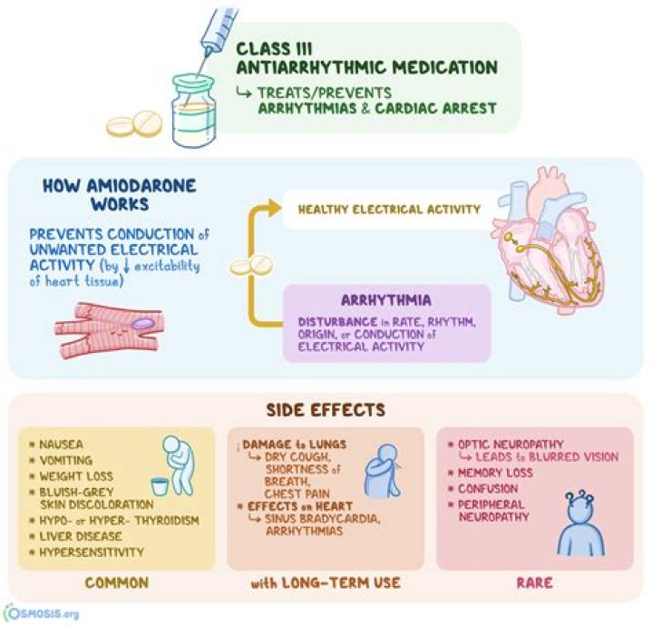 Is amiodarone a negative Inotrope