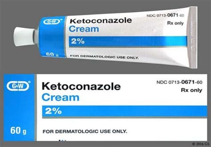 Is ketoconazole cream available over the counter