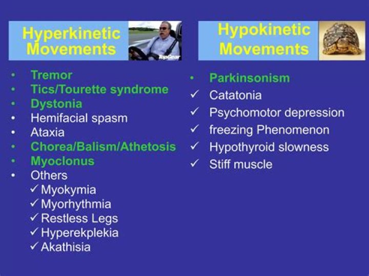 Is Parkinsons hyperkinetic or hypokinetic
