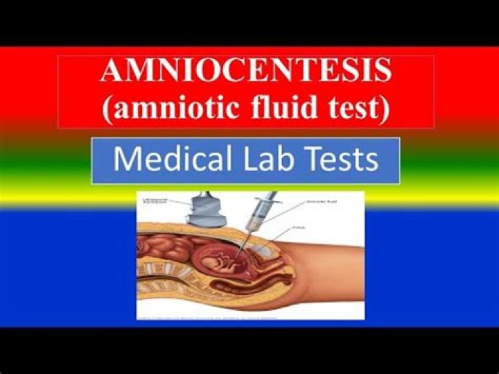 Is the amniocentesis test painful
