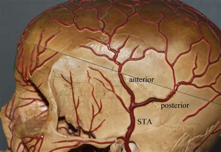 Is the temporal artery visible
