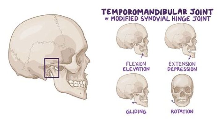 Is TMJ unilateral or bilateral