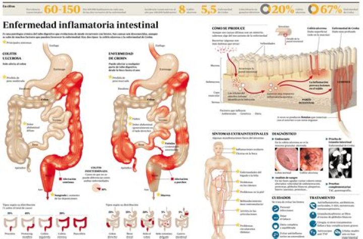 ¿Qué es la enfermedad de Crohn