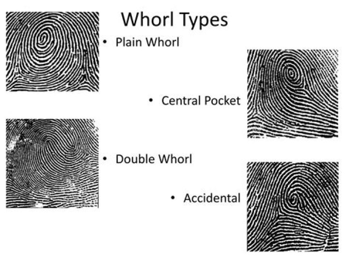 What are the 4 types of whorls