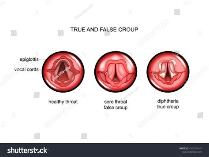 What are the false vocal folds