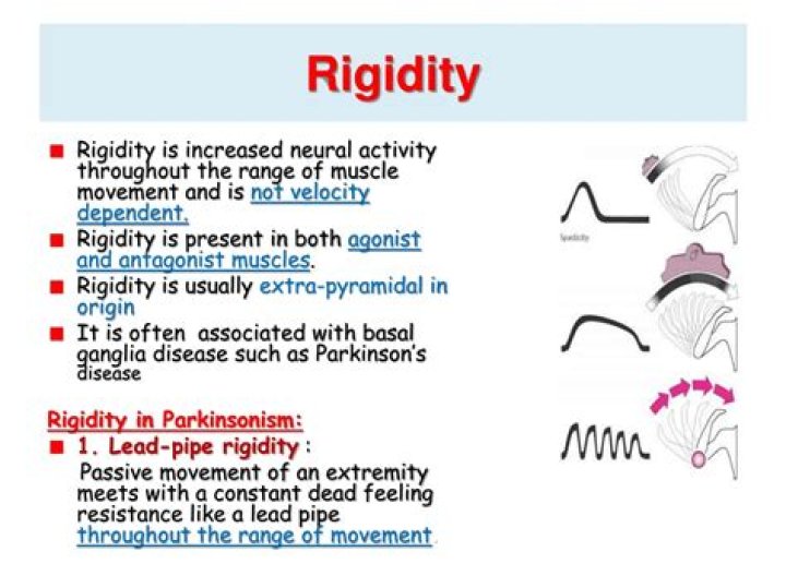 What are the types of rigidity