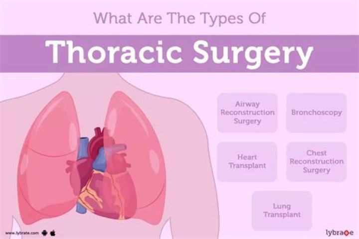 What are the types of thoracic