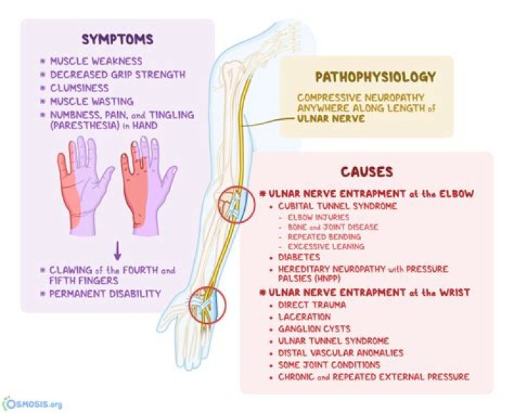 What are ulnar nerve symptoms