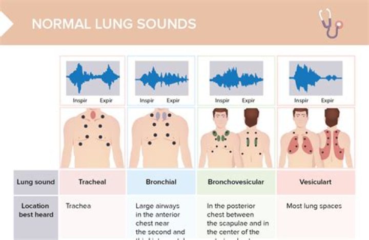What breath sounds are heard with chronic bronchitis