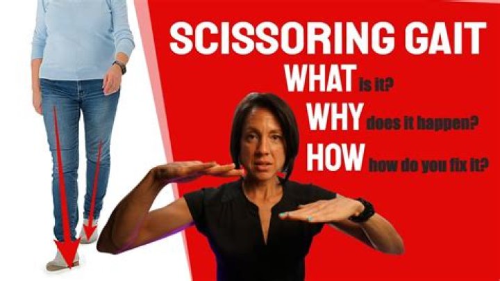 What causes a scissoring gait
