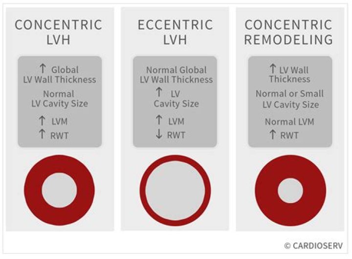 What causes concentric remodeling