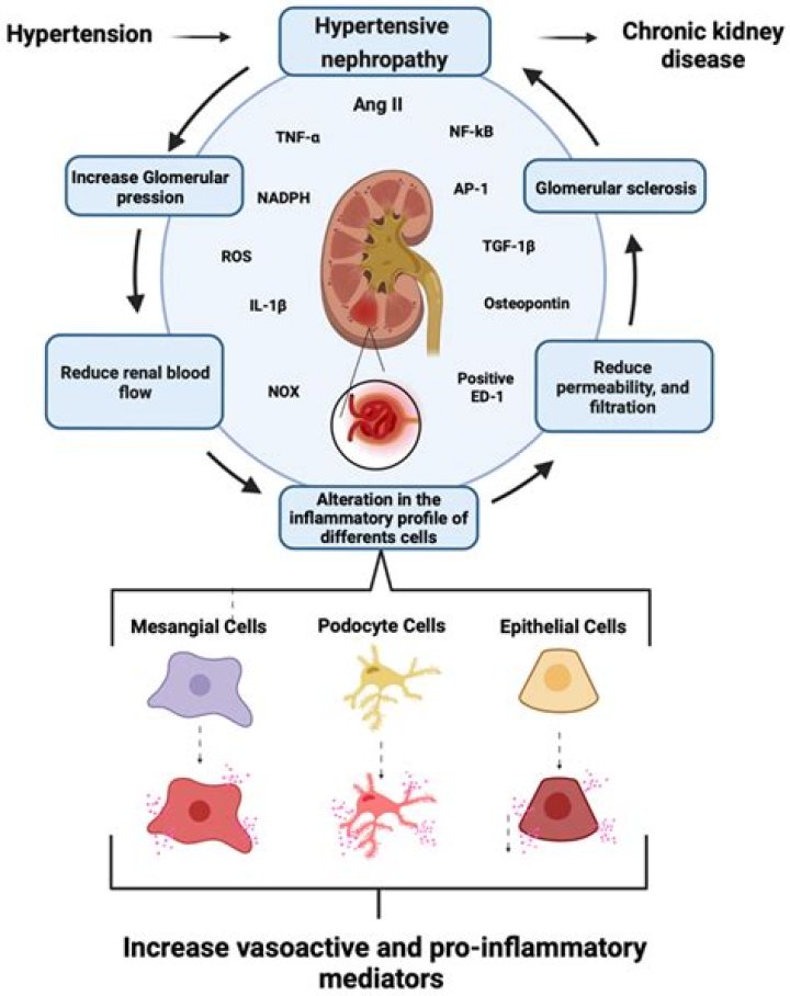 What causes glomerular disease