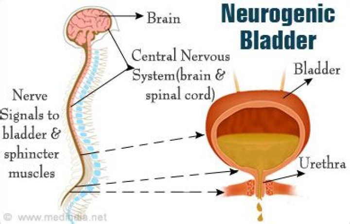 What causes neurogenic bladder