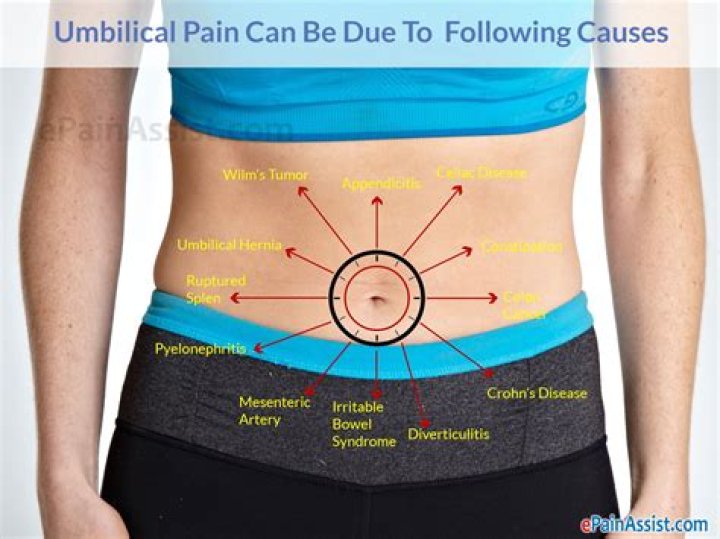 What causes Periumbilical pain