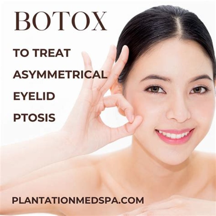 What causes ptosis with Botox