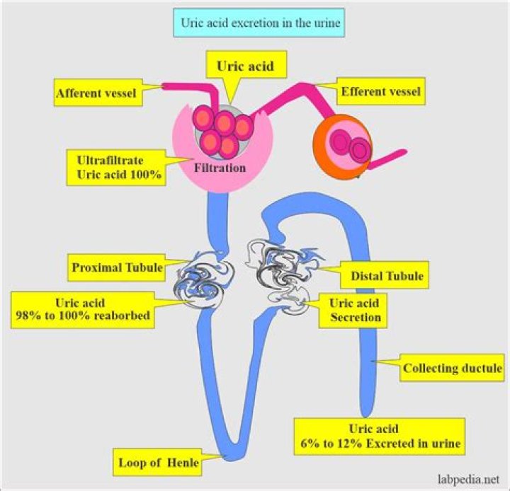 What causes uric acid in urine