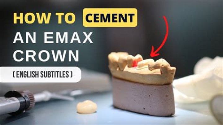 What cement is used for crowns