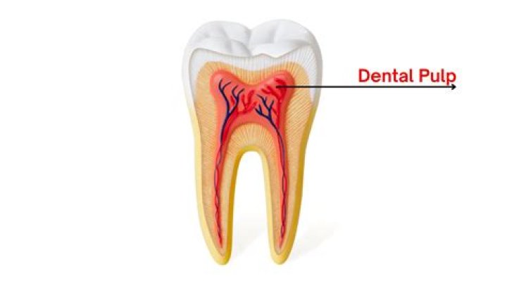 What color is dental pulp