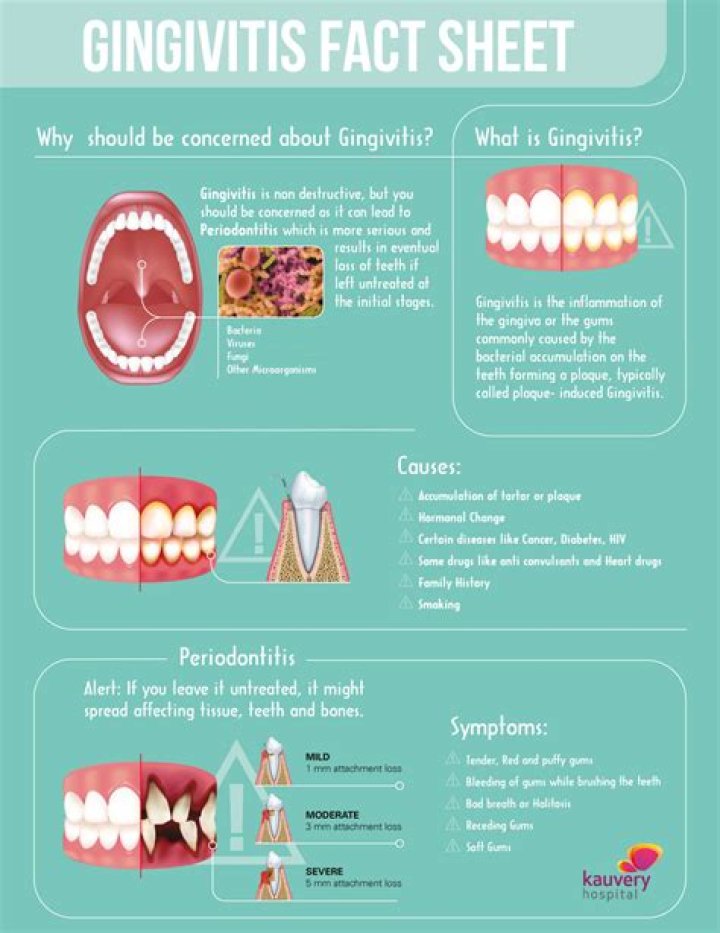 What deficiency causes gingivitis
