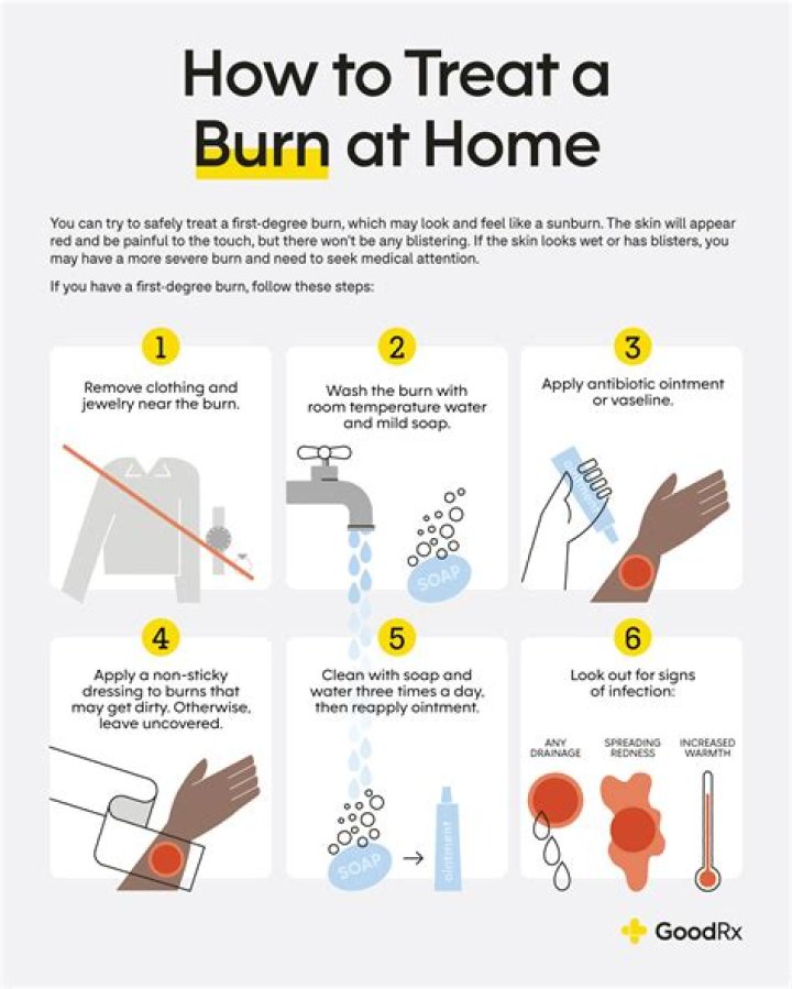 What helps burns heal quicker