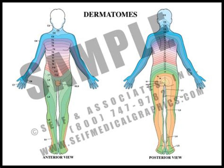 What is a dermatome procedure