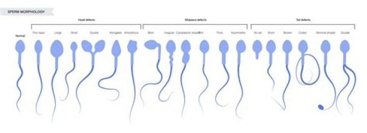What is a good sperm analysis